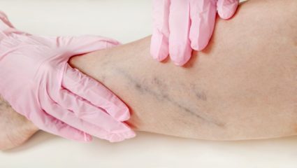 ‘ही’ तीन पानं रक्तात जमलेलं युरीक ॲसिड काढतात बाहेर, रोज चावून करा सेवन