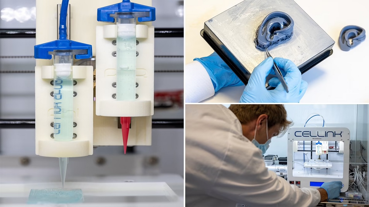 Ears Raised By 3d Printing Iisc Research Is Also Effective On Brain Stroke Nrvk