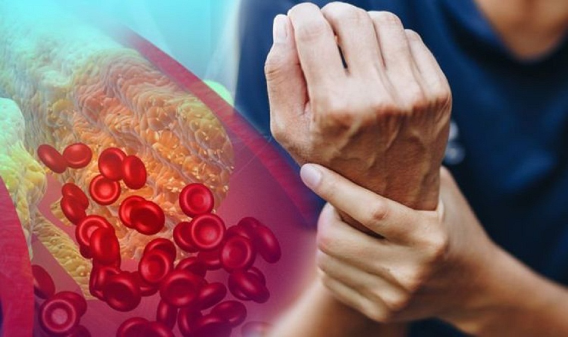 कोलेस्टेरॉल वर नियंत्रण मिळवायचं आहे, मग हे नक्की वाचा!
