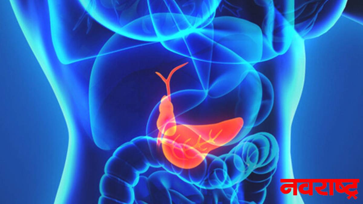 पित्ताशयात खडे का होतात ? जाणून घ्या