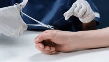 जखम झाली म्हणून गेला उपचाराला पण टाक्यांऐवजी लावले फेविक्विक; चिमुकल्याबाबत घडला विचित्र प्रकार