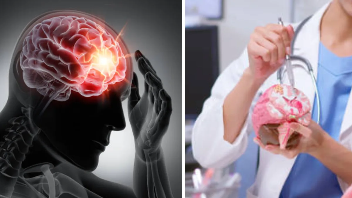 ब्रेन ट्यूमरचे प्रकार, कारणे, लक्षणे, निदान आणि उपचार