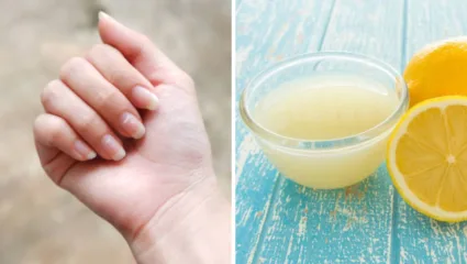 नखं तुटण्याने नका होऊ उदास, नखांच्या मजबूत वाढीसाठी करा लिंबाच्या रसाचा वापर दिसतील आकर्षक