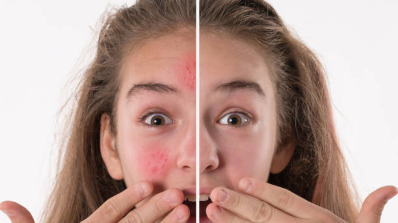 फेस ट्रॉमाची लक्षणे (फोटो सौजन्य - iStock0