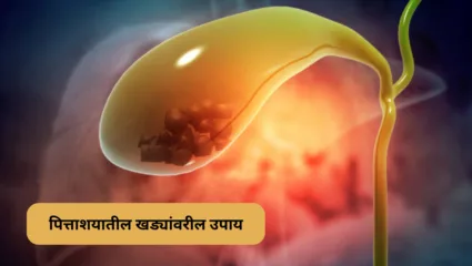 पित्ताशयातील खड्यांवर वेळीच करा उपचार, अन्यथा होतील गंभीर परिणाम
