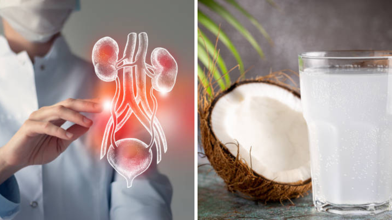 तज्ज्ञांच्या मते, जेव्हा किडनी स्टोन तयार होतात तेव्हा डॉक्टर भरपूर पाणी पिण्याचा सल्ला देतात, जेणेकरून खडे स्वतःच बाहेर पडतात