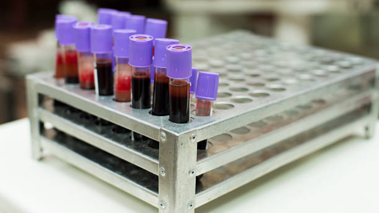 चाचणी करणे का आवश्यक आहे