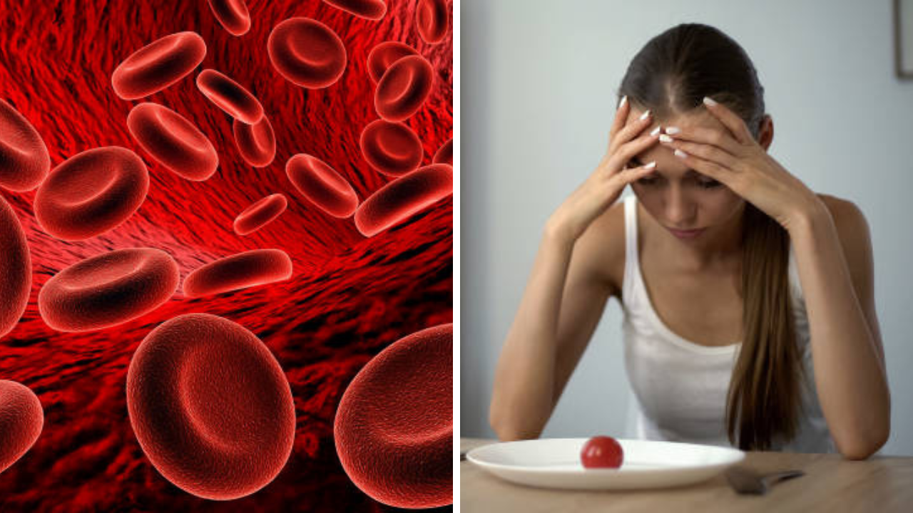 Iron Deficiency अॅनिमिया: जागरूक राहून धोका कमी करा आयर्न डेफिशियन्सी अॅनिमिया