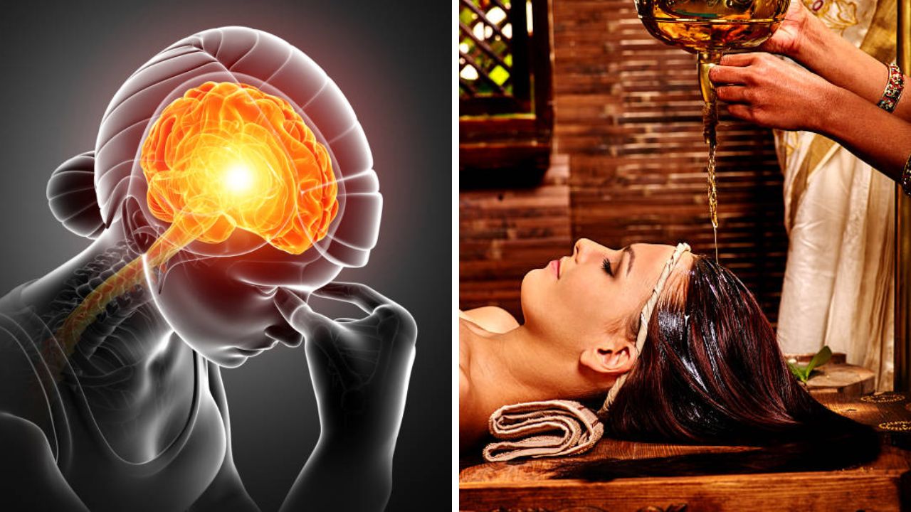 मायग्रेनवर आयुर्वेदिक उपाय