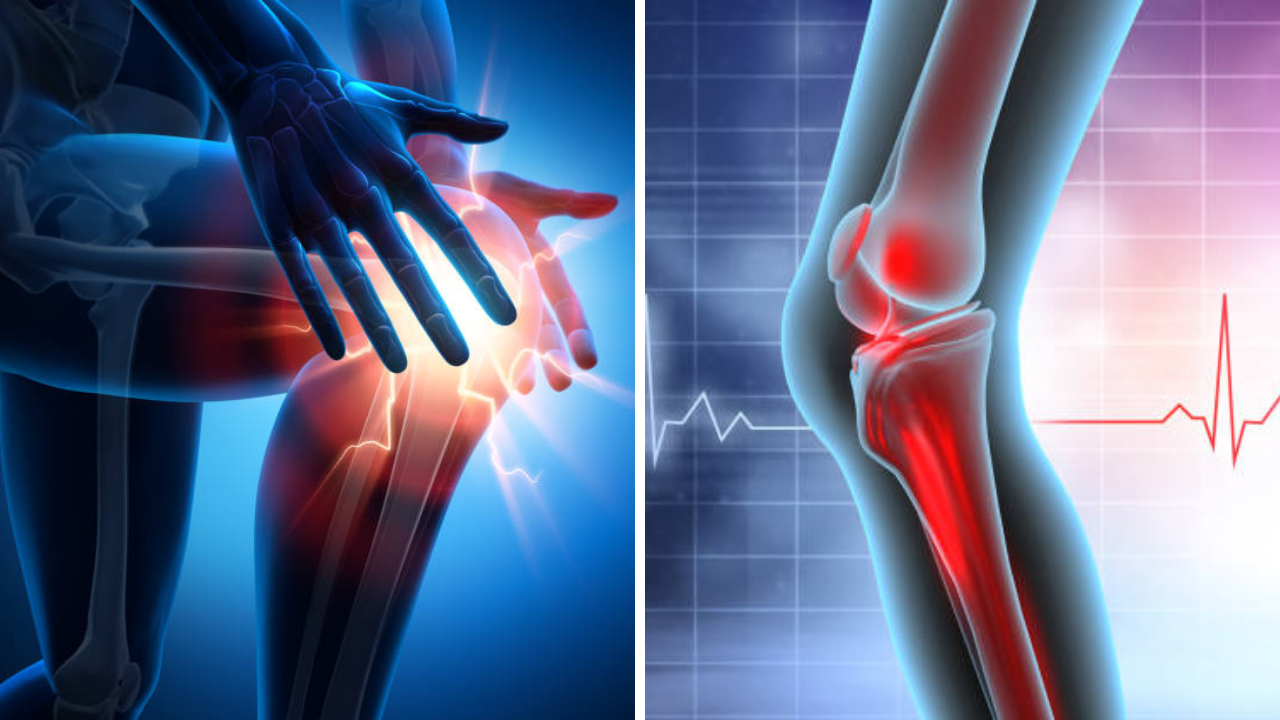 गुडघ्याची शस्त्रक्रिया कधी करावी