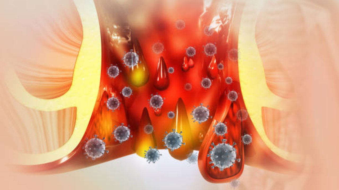 यामध्ये मुबलक प्रमाणात असलेले फायबर बद्धकोष्ठतेपासून आराम देते आणि पचनसंस्था पूर्णपणे तंदुरुस्त करते