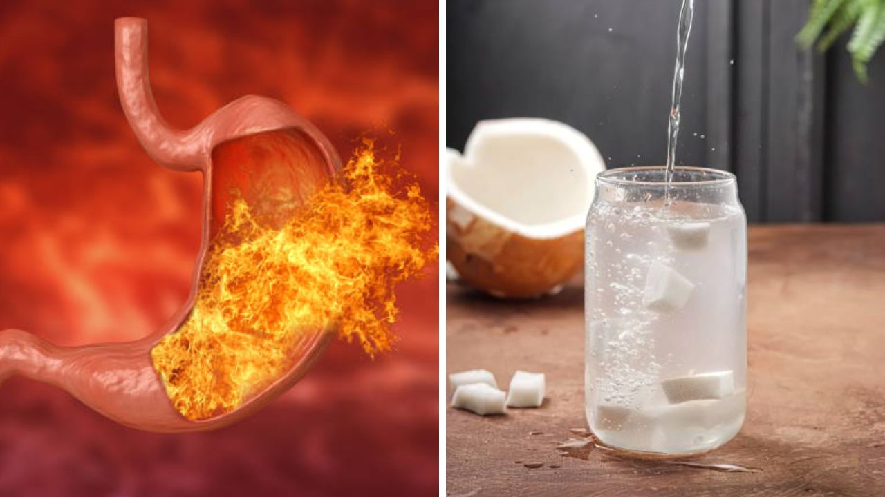 ॲसिडिटीपासून आराम मिळवण्यासाठी या पदार्थांचे सेवन करा