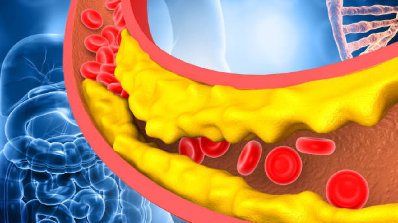 सकाळीच खाल ‘हे’ पदार्थ Bad Cholesterol होईल छुमंतर, का म्हणतात या आजाराला सायलंट किलर?