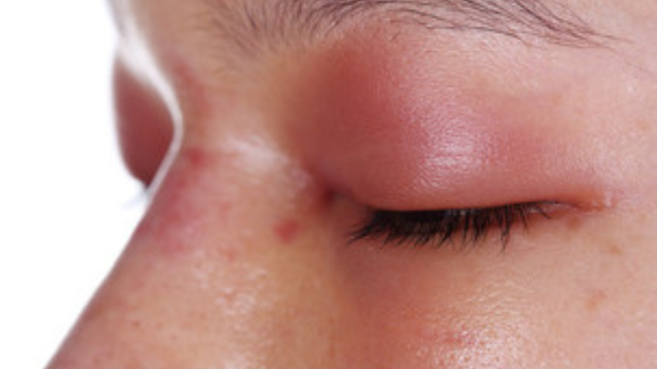 ज्योतिषशास्त्रानुसार शनीची साडेसाती सुरू होताच मेष राशीच्या लोकांना आरोग्याशी संबंधित समस्यांना सामोरे जावे लागू शकते. डोळ्यांशी संबंधित समस्या त्रास या काळात होऊ शकतात. पायाला दुखापत इत्यादी समस्या असू शकतात. त्यामुळे कोणत्याही शारीरिक समस्येच्या बाबतीत दुर्लक्ष करू नका