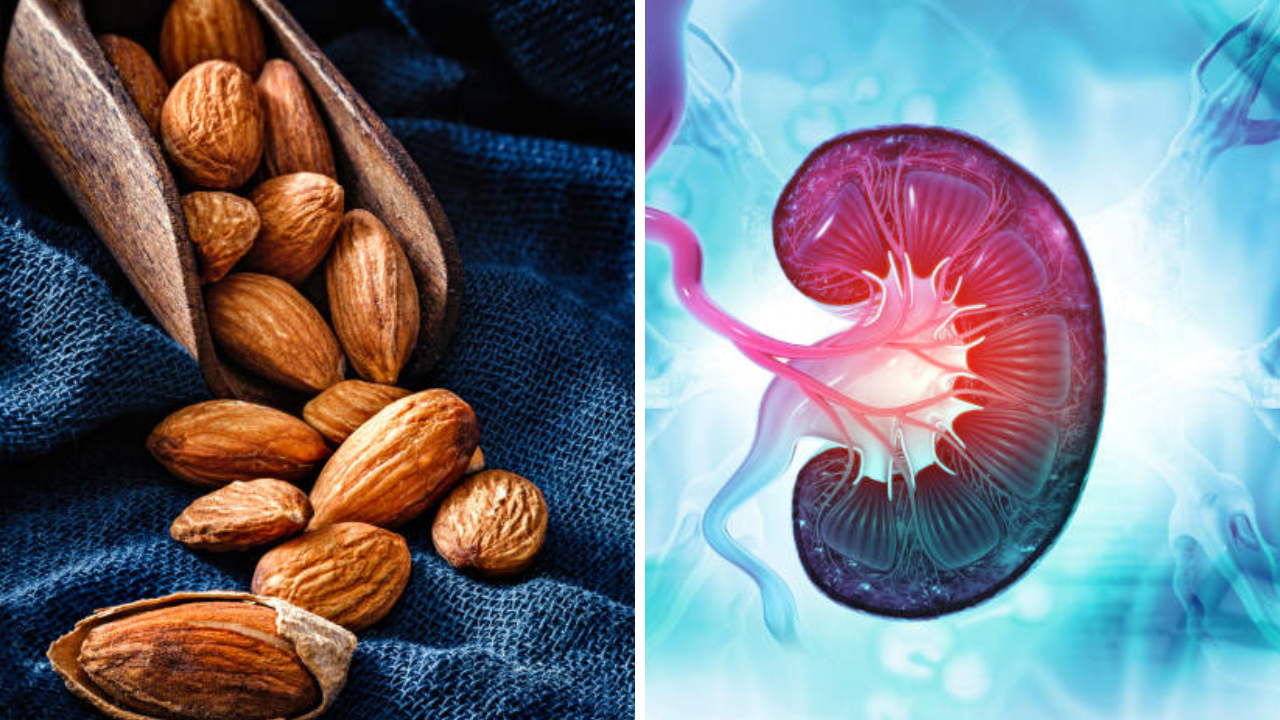 बदाम खाण्याने किडनीवर होतो परिणाम, मुतखड्याचे कारण