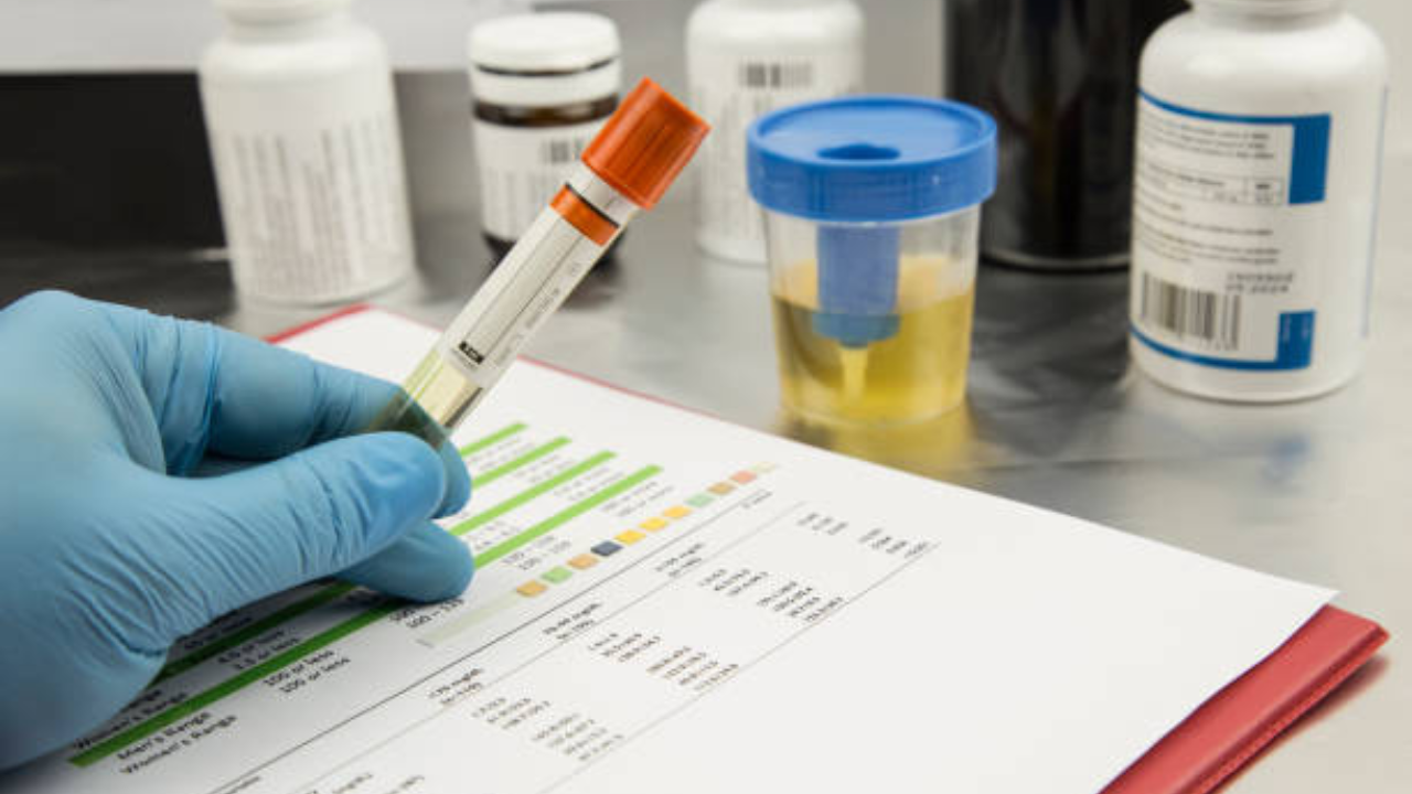 अनेक वेळा रंगीत पदार्थ किंवा ॲलोपॅथीची औषधे जास्त प्रमाणात खाल्ल्यास लघवीचा रंग हिरवा-तपकिरी होऊ शकतो, परंतु तसे नसल्यास ताबडतोब डॉक्टरांकडे जाऊन तपासणी करून घ्यावी