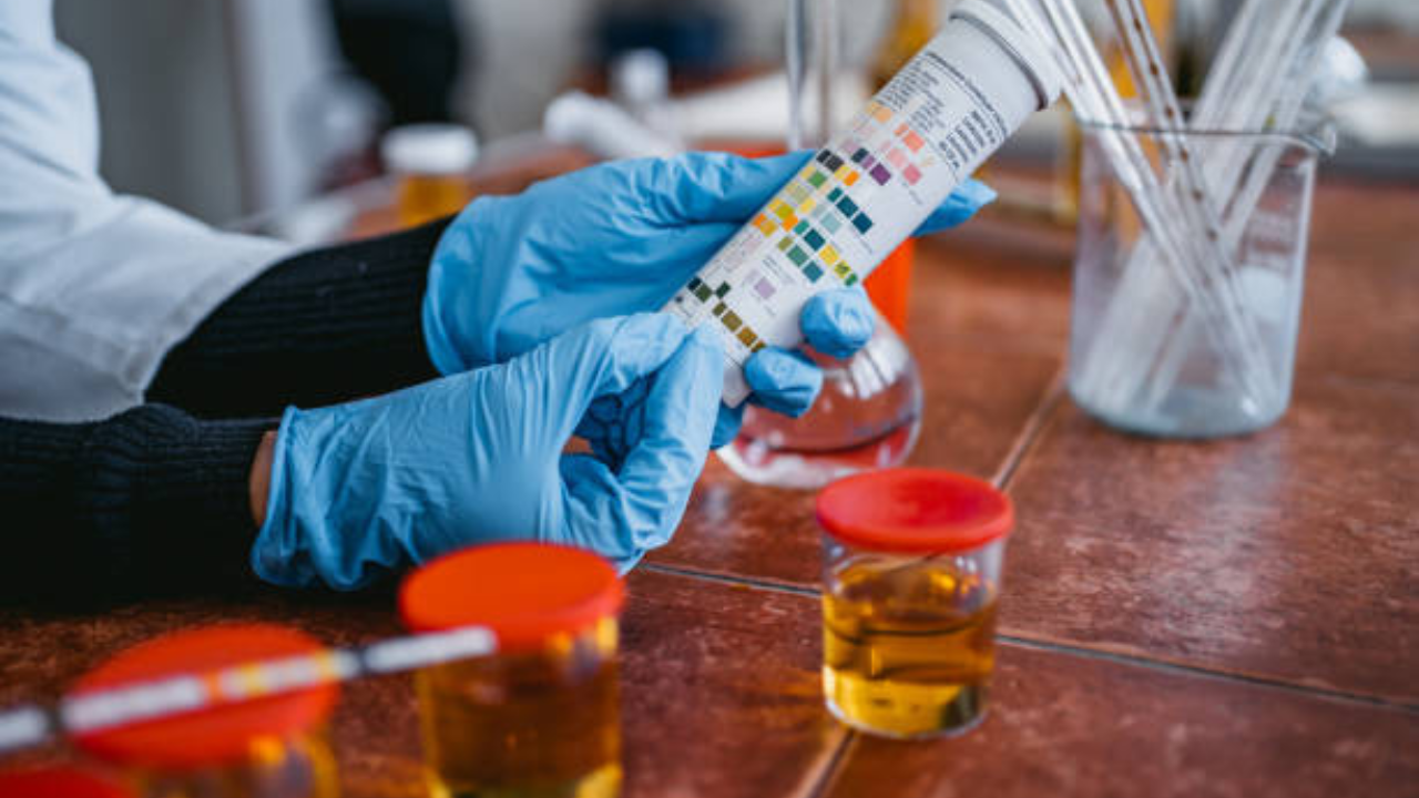 तुम्ही लॅबमध्ये अनेकदा युरीन तपासणीसाठी दिले असेल. पण कधी विचार केलाय का? कोणता आजार आहे हे ओळखण्यासाठी युरीन का मागवले जाते? जाणून घ्या अधिक माहिती