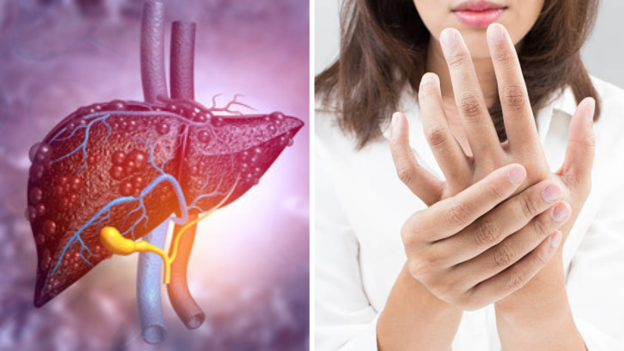लिव्हरच्या कोपऱ्यातही चिकटचे चरबी, हातावर दिसतील ‘अशी’ लक्षणे; व्हा सावध!