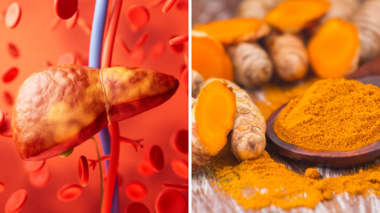 Fatty Liver साठी हळदीचे पाणी चांगले ठरते की नाही, काय सांगतात तज्ज्ञ
