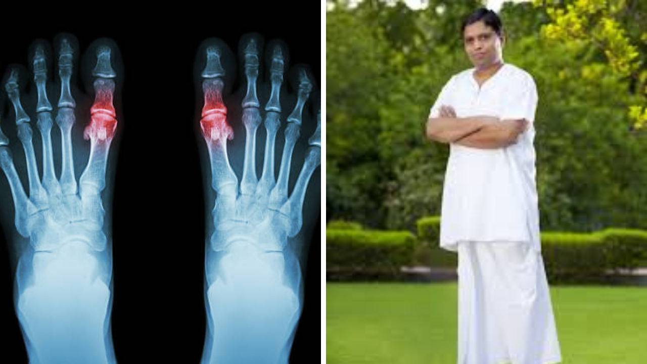 Acharya Balkrishna यांनी सांगितला Uric Acid चा उत्तम उपाय, ‘चमत्कारी औषधा’ने होईल विषाचा खात्मा