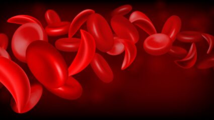 Sickle Cell : चंद्रपूर जिल्ह्यात 38221 सिकलसेलचे वाहक, रक्तातून पिढ्यानुपिढ्या संसर्ग
