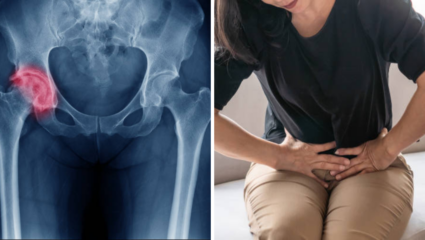 Menopause नंतर महिलांमध्ये वाढतोय Hip Fracture चा धोका, आहाराबरोबरच हवी व्यायामाची जोड