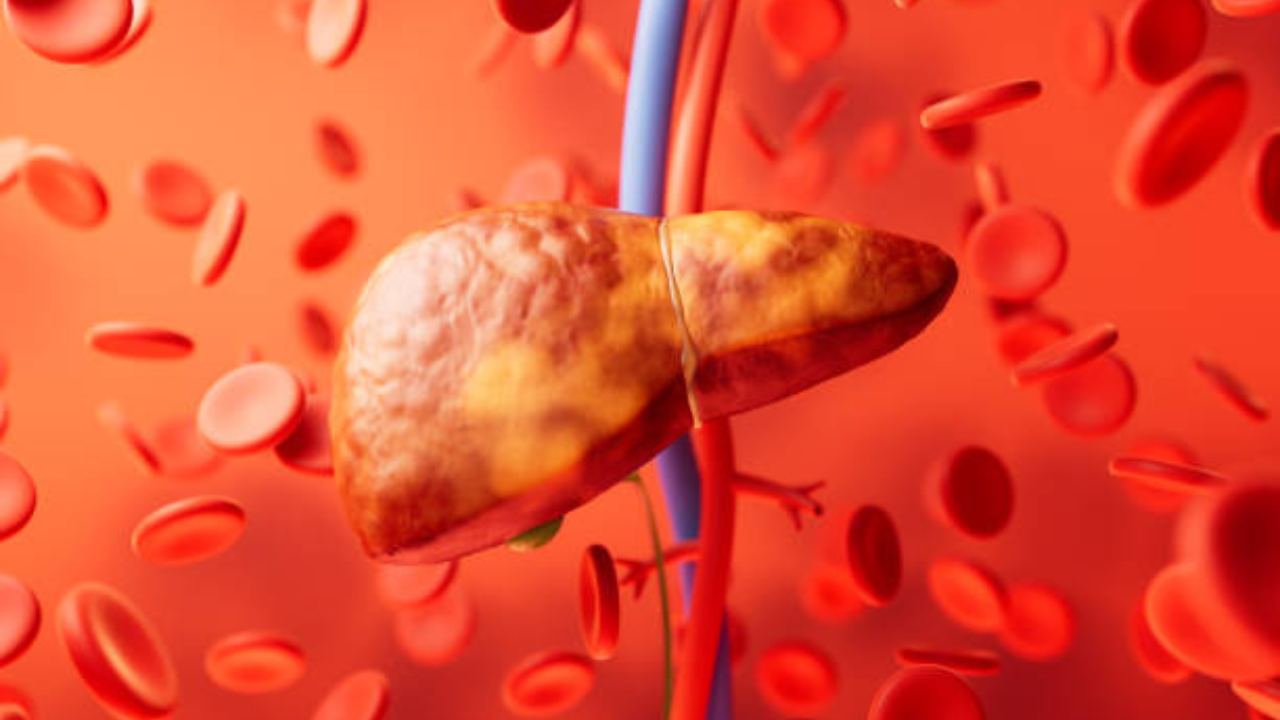 डॉ. सौरभ यांनी इंस्टाग्रामवर एक पोस्ट शेअर केली आणि सांगितले की हे ३ पेये फॅटी लिव्हर वाढवू शकतात आणि सिरोसिस सारख्या धोकादायक आजाराला कारणीभूत ठरू शकतात.