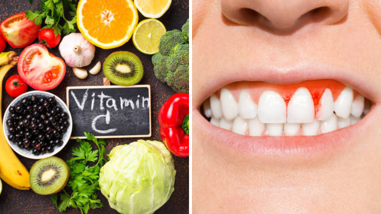 विटामिन सी ची कमतरता कोणत्या फळांनी भरून काढता येईल (फोटो सौजन्य - iStock)