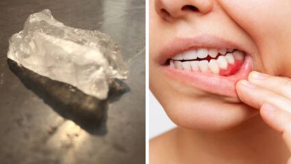 10 रुपयांचा हा सफेद दगड दातांना मुळांपासून बनवेल मजबूत, पिवळेपणाचं काय तर तोंडाची दुर्गंधीही होईल दूर