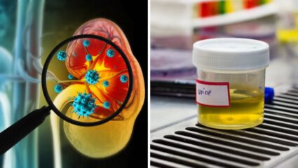 सकाळी उठल्यानंतर लघवीचा रंग पिवळा दिसेल असेल तर सावधान! शरीरसंबंधित दिसून येतात ‘या’ गंभीर आजाराचे संकेत