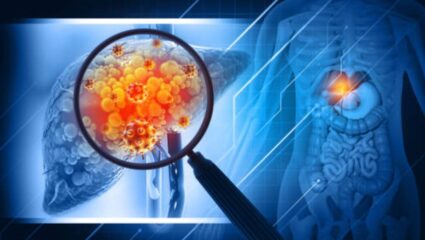 Liver Care: लिव्हर सडल्यानंतर मानेवर दिसून येतात ‘ही’ महाभयंकर लक्षणे, दुर्लक्ष केल्यास ओढावेल अकाली मृत्यू