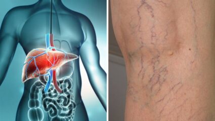 दारू न पिताही सोडू शकते लिव्हर! पायांमध्ये दिसणाऱ्या ‘या’ लक्षणांकडे अजिबात करू नका दुर्लक्ष, वेळीच घ्या डॉक्टरांचा सल्ला