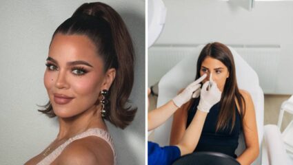 Khloe Kardashian ने केली Rhinoplasty शस्त्रक्रिया! जाणून घ्या राइनोप्लास्टी केल्यामुळे त्वचेला होणारे फायदे
