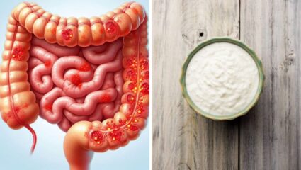 आतड्यांमध्ये चिकटलेली घाण क्षणार्धात पडून जाईल बाहेर! दह्यात मिक्स करून ‘ही’ गुणकारी पावडर, शरीर आतून राहील स्वच्छ