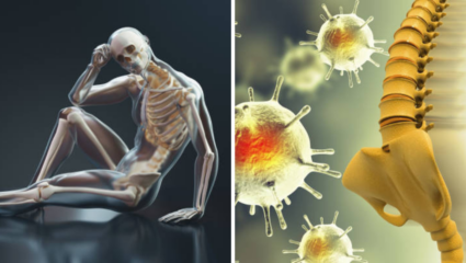 हाडं ठिसूळ झाल्याने कधीही शरीराचा होईल सांगाडा, Bone Cancer ची 6 लक्षणं दिसताच गाठा हॉस्पिटल