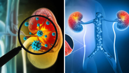 16% पेक्षा जास्त लोकांची किडनी सडलेली, 8 पदार्थ करत आहेत तारूण्य खराब; त्वरीत व्हा दूर नाहीतर मृत्यू अटळ