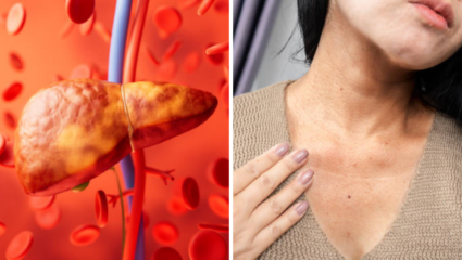 मानेवर दिसतात Liver सडण्याची 4 लक्षणं, 5 सवयी सोडल्या नाहीत तर आयुष्यभराची कमाई जाईल डॉक्टरच्या खिशात