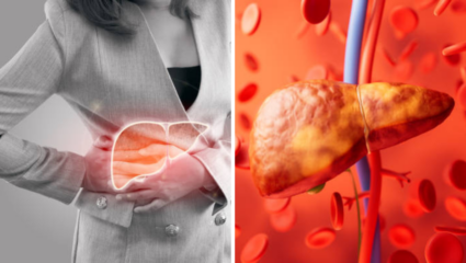 केवळ 5 रूपयात किडनीवर उपचार, फॅटी लिव्हरही होईल नष्ट; 2 पदार्थांचे सेवन ठेवेल तुम्हाला निरोगी