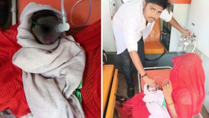 Madhya Pradesh News : पांढरी त्वचा, डोळे बाहेर आलेले, संपूर्ण शरीराला भेगा; मध्य प्रदेशात जन्माला आला ‘एलियन बेबी’