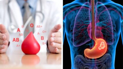 ‘या’ ब्लड ग्रुपच्या लोकांना असतो Stomach Cancer चा सर्वाधिक धोका; तुमचे नाव तर यात सामील नाही?