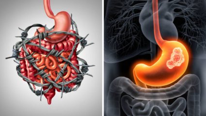 IBS आणि कोलन कॅन्सरमध्ये काय आहे फरक? लक्षणं एकसारखीच; उडू शकतो गोंधळ