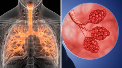 World Lung Cancer Day: न कळताच फुफ्फुसे वितळतील, सुरुवातीलाच ५ लक्षणे न आढळल्यास कॅन्सर निश्चित, १ टेस्ट करून घ्या