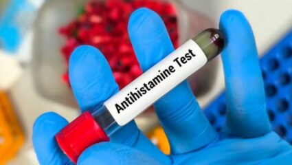 २२ वर्षीय मुलीचा अ‍ॅलर्जीमुळे मृत्यू! शरीरात दिसणाऱ्या ‘या’ लक्षणांकडे अजिबात करू नका दुर्लक्ष, चुकूनही घेऊ नका हलक्यात