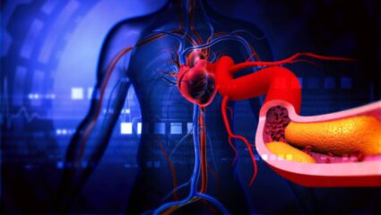 उच्च रक्तदाबामुळे महिलांमध्ये वाढतोय heart attack चा धोका! हृद्यासंबंधित आजारापासून सुटका मिळवण्यासाठी ‘हे’ उपाय ठरतील प्रभावी