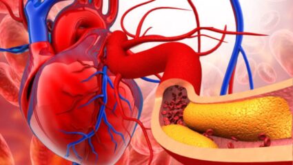 रक्तवाहिन्यांमध्ये साचलेले घाणेरडे कोलेस्ट्रॉल कायमचे नष्ट करण्यासाठी ‘हे’ पदार्थ ठरतील प्रभावी, सर्वच शिरांमधून वाहील ऑक्सिजन