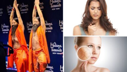 पावसाळ्यात वाढते फंगल इन्फेक्शन आणि कोंड्याची समस्या, Baba Ramdev यांचा त्वचा आणि केसांसाठी रामबाण उपाय