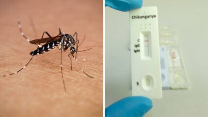 20 वर्षापूर्वी जगात धुमाकूळ घालणाऱ्या Virus चा पुन्हा हाहाःकार, 119 देशांवर घोंघावतोय ‘धोका’; WHO चा इशारा