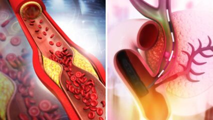 Cholesterol Remedies: शरीरातून खेचून काढेल कोलेस्ट्रॉल, विरघळून निघेल पिवळा कचरा; 10 पदार्थांचा करा समावेश
