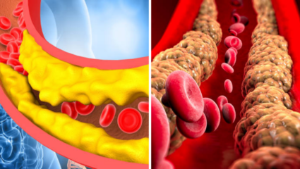 Cholesterol Remedy: नसांमध्ये चिकटलेली चरबी ‘ही’ भाजी खाऊन झटकन वितळेल, वाढेल नैसर्गिक गुड कोलेस्ट्रॉल