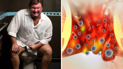 Constipation: सकाळीच पोटात शौच राहतेय चिकटून, Potty Problems होईल झटक्यात दूर; ‘हा’ पदार्थ खाण्याचा डाएटिशियनचा सल्ला